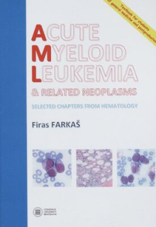 Acute myeloid leukemia & related neoplasms. Selected chapters from hematology 
